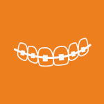 Dental braces